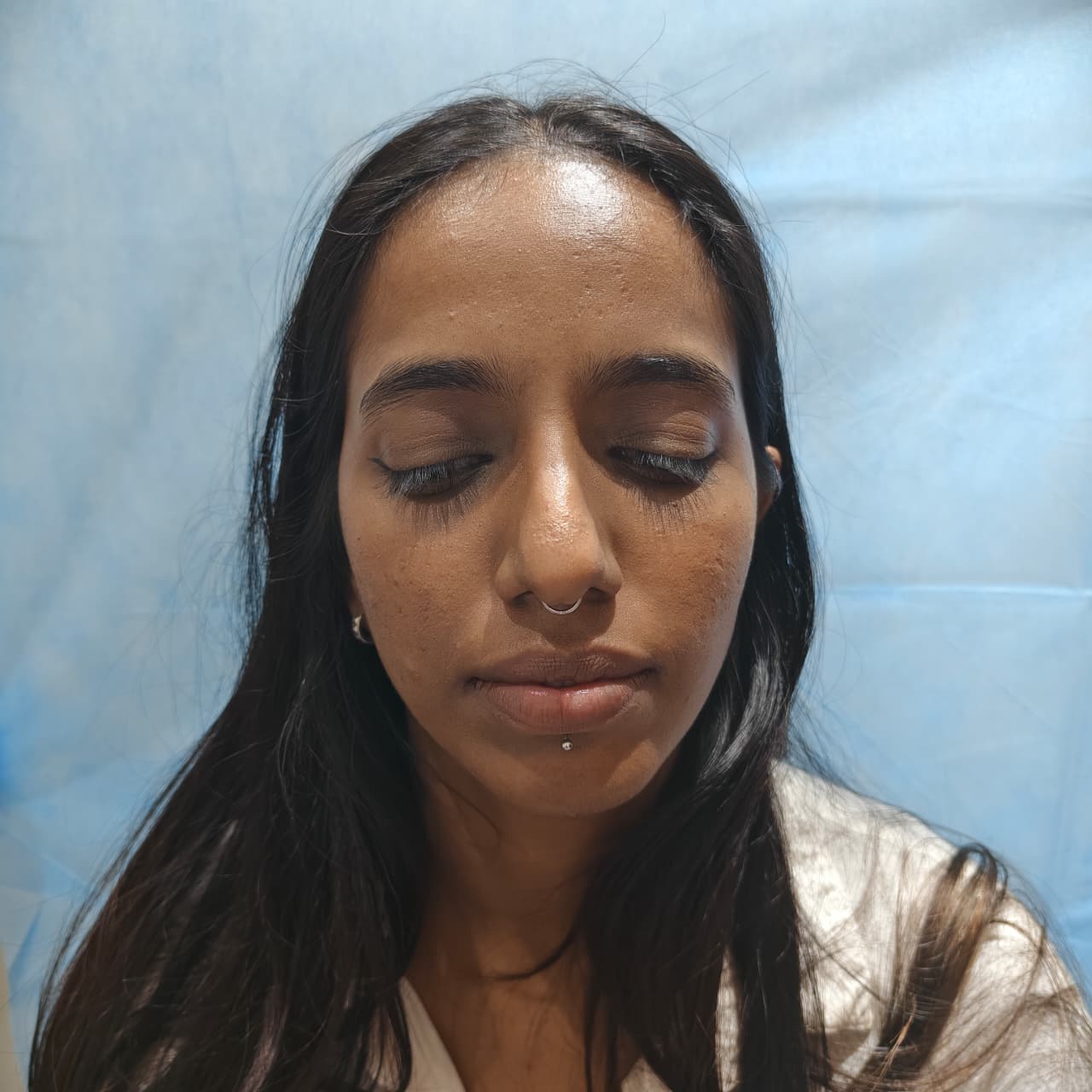 Advanced Treatment Room